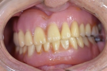 駒込歯科クリニックのブログ